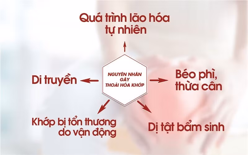 Những nguyên nhân chính gây thoái hóa khớp gối