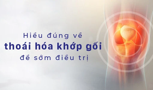 Hiểu đúng về thoái hóa khớp gối để có phương pháp điều trị thích hợp