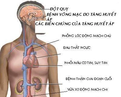 Ngăn ngừa đột quỵ - Hãy tuân thủ những nguyên tắc vàng