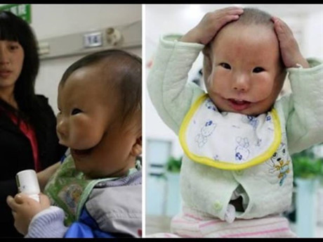 Những con người kỳ lạ nhất thế giới - Ảnh 4 Nhung con nguoi ky la nhat the gioi - Anh 4