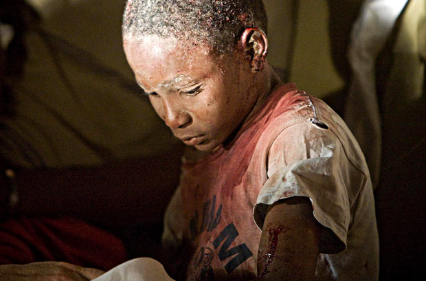 Máu và nước mắt thấm đẫm Haiti ảnh 12 An injured person is tended to at Hotel Villa Creole in Port-au-Prince