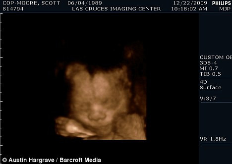 Hình ảnh một bé trai trong bụng Scott sẽ mang tên Miles It’s a boy! The scan reveals Scott is expecting a boy - which will be named Miles Read more: http://www.dailymail.co.uk/news/worldnews/article-1246153/Second-pregnant-man-Scott-Moore-birth-baby-boy-month.html#ixzz0dmfbfsIQ