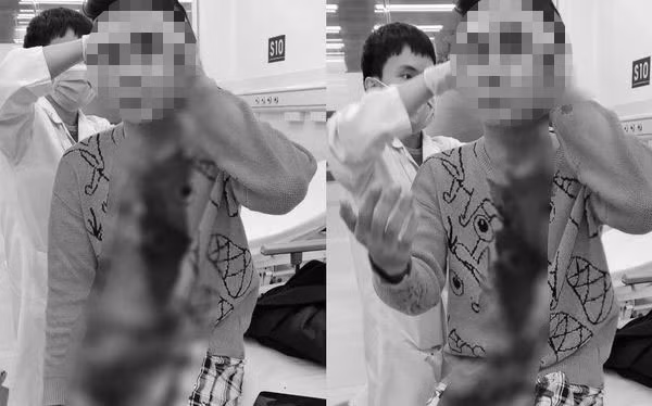 Nam diễn viên Ngô Sỹ Lâm bị một đối tượng dùng dao tấn công gây thương tích.