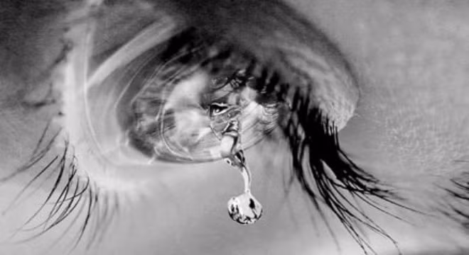 Bệnh "lệ rơi", chậm điều trị "khóc" cả đời