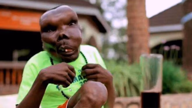 Chàng ca sĩ xấu nhất thế giới thành biểu tượng chiến thắng số phận