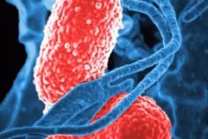 Sự thật đáng sợ về vi khuẩn kháng kháng sinh