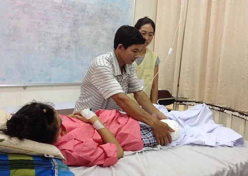 Nữ sinhlớp 10 sau nhiều ngày bó bột do gãy mâm chày, động mạch nuôi cẳng chân phảibị tắc hoàn toàn, hoại tử lan rộng,các bác sĩ phải mổ cắt bỏ 1/3 dưới đùi phải để giữ tính mạng bệnh nhân. Ảnh:T.N