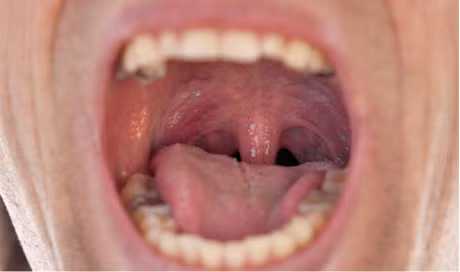 Ngu ngay la bieu hien cua benh gi? - Anh 2