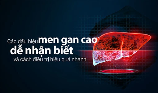 Dấu hiệu men gan cao nhận biết sớm để có cách điều trị