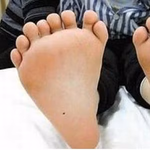 Người có nhiều ngón tay, ngón chân nhất