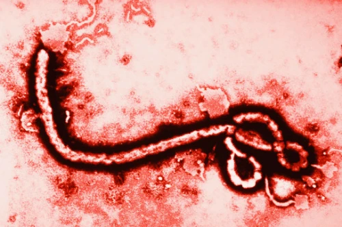 Virus Ebola không truyền qua đường không khí. Ảnh: huffpost