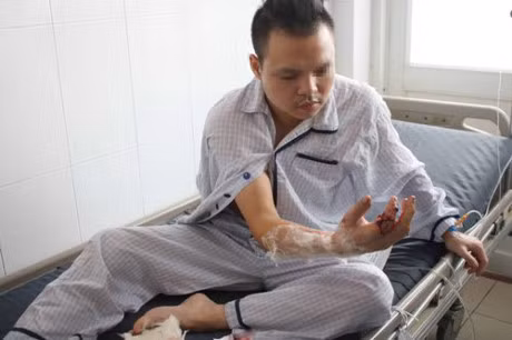 Bi may xay thit nghien dut lia ngon tay, mat 4 gio de vi phau noi - Anh 1