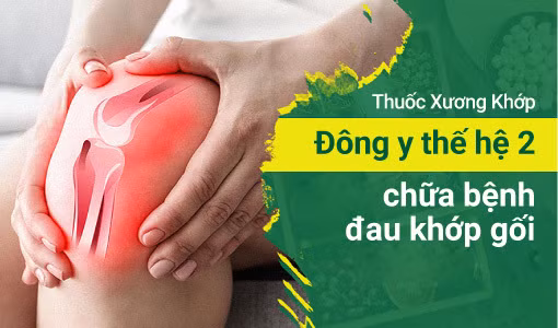 Thuốc Xương Khớp Đông y thế hệ 2 chữa bệnh đau khớp gối được tin dùng ảnh 1 đau khớp gối
