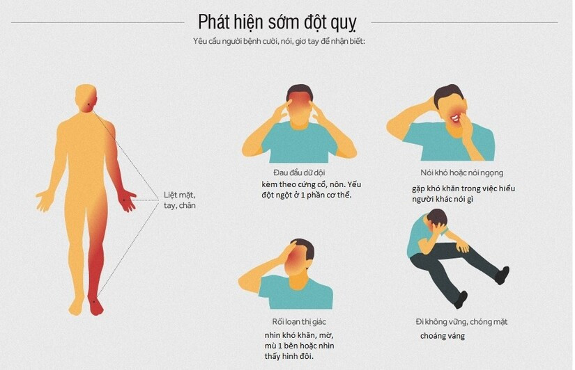 dấu hiệu cảnh báo tai biến