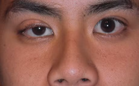 Phat hien 9 dau hieu nho nay tren co the, hay canh giac voi nhung can benh nguy hiem - Anh 1