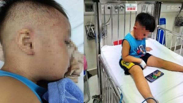 Cháu Đ. vẫn đang được chăm sóc, theo dõi tại bệnh viện.