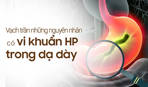 "Vạch trần" những nguyên nhân có vi khuẩn HP trong dạ dày