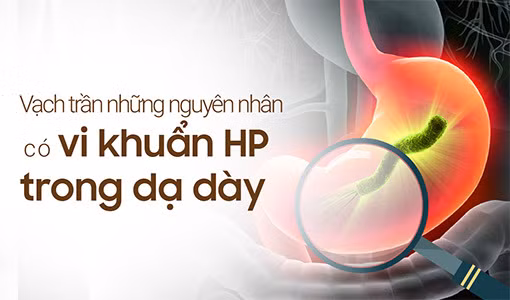 "Vạch trần" những nguyên nhân có vi khuẩn HP trong dạ dày