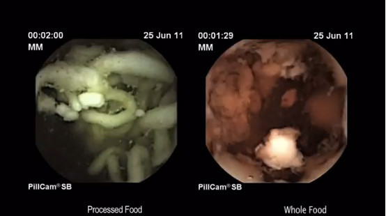 Bằng 1 camera siêu nhỏ hình con nhộng, các chuyên gia đã phát hiện ra rằng sợi mỳ không hề được tiêu hoá trong dạ dày sau 2 tiếng