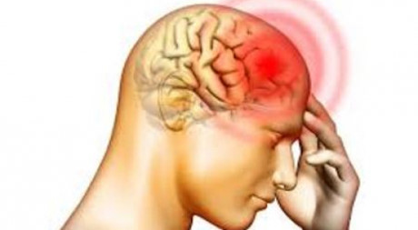 Chụp cộng hưởng từ não để phát hiện nhiễm HIV - Ảnh 1 Chup cong huong tu nao de phat hien nhiem HIV - Anh 1