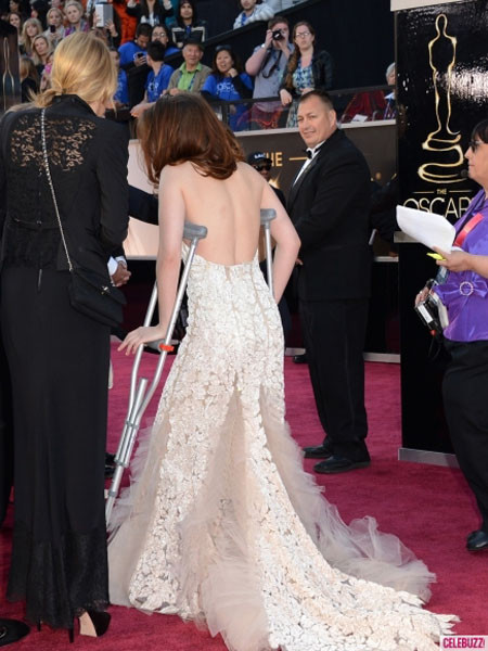 Kristen gây tò mò cho nhiều người với đôi nạng Kristen gây tò mò cho nhiều người với đôi nạng