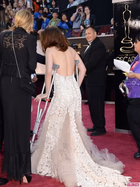Kristen gây tò mò cho nhiều người với đôi nạng