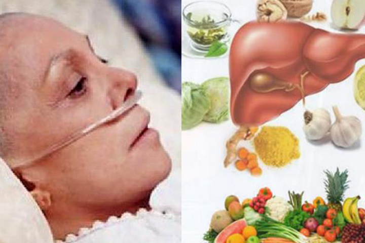 3 nguyên tắc vàng chặn đứng sự hình thành khối u