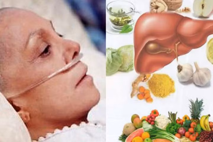 3 nguyên tắc vàng chặn đứng sự hình thành khối u