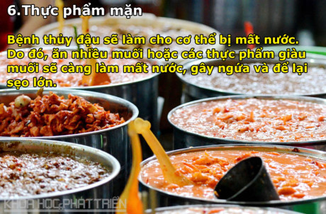 Bị bệnh thủy đậu kiêng ăn, uống thứ gì? - Ảnh 6 Bi benh thuy dau kieng an, uong thu gi? - Anh 6