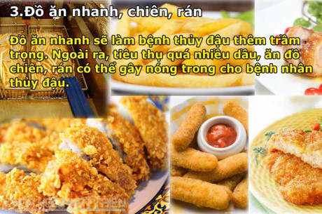Bị bệnh thủy đậu kiêng ăn, uống thứ gì? - Ảnh 3 Bi benh thuy dau kieng an, uong thu gi? - Anh 3