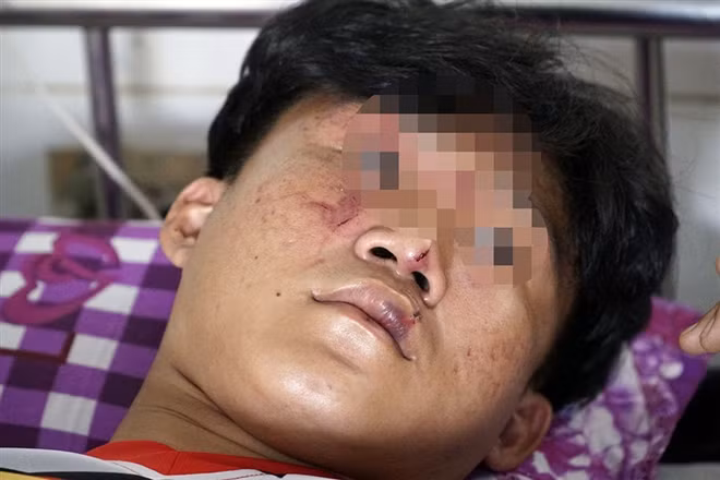 Nam sinh trường THPT Tháp Mười nhập viện sau khi bị nhóm côn đồ đánh đập. Ảnh: VietnamNet