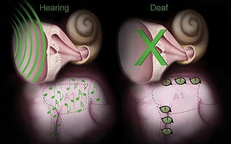 Người khiếm thính &quot;có khả năng phát triển siêu thị lực&quot;