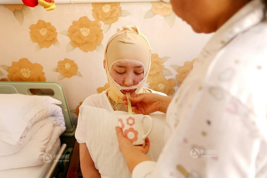 Hai năm trôi qua mọi sinh hoạt của cô vẫn phải nhờ mẹ.