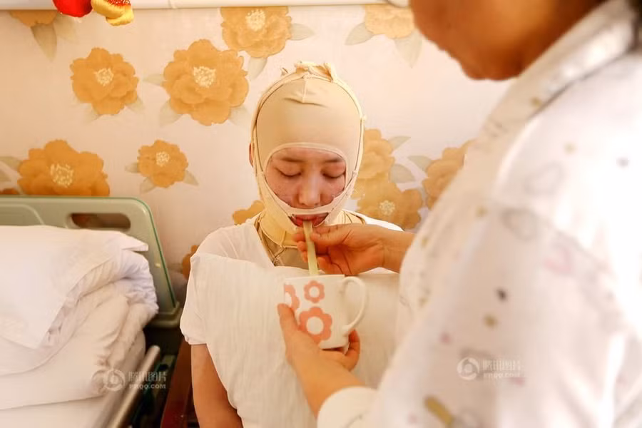 Hai năm trôi qua mọi sinh hoạt của cô vẫn phải nhờ mẹ.