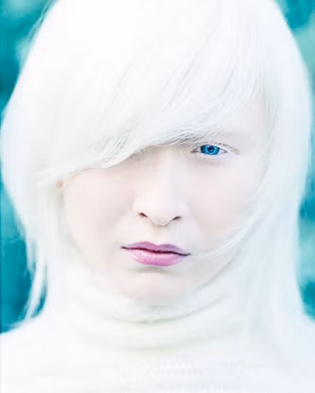 Với màu da, tóc trắng phau, đôi mắt màu nhạt khác biệt nhưng Connie Chiu sở hữu gương mặt xinh xắn và vóc dáng cân đối. Với màu da, tóc trắng phau, đôi mắt màu nhạt khác biệt nhưng Connie Chiu sở hữu gương mặt xinh xắn và vóc dáng cân đối.