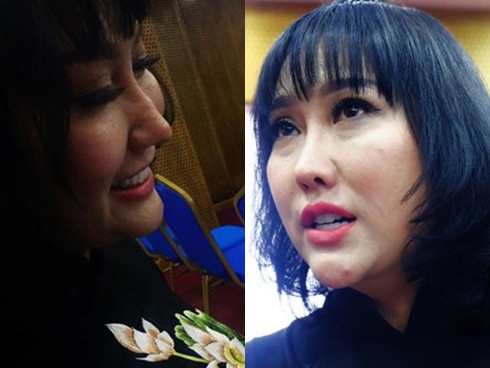 Những sao Việt phẫu thuật thẩm mỹ khiến khán giả xót xa tiếc nuối - Ảnh 2. Những sao Việt phẫu thuật thẩm mỹ khiến khán giả xót xa tiếc nuối - Ảnh 2.