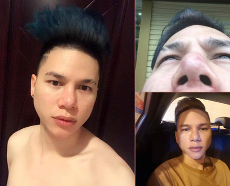 Những sao Việt phẫu thuật thẩm mỹ khiến khán giả xót xa tiếc nuối - Ảnh 5. Những sao Việt phẫu thuật thẩm mỹ khiến khán giả xót xa tiếc nuối - Ảnh 5.