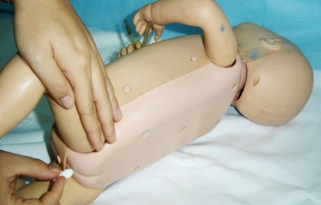 Tre sot cao co giat, cach xu tri don gian den khong ngo - Anh 3