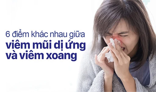 Viêm mũi dị ứng và viêm xoang thường bị nhầm lẫn