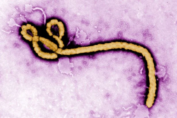 Người tham gia thử văcxin Ebola sẽ được trả 750 bảng Anh