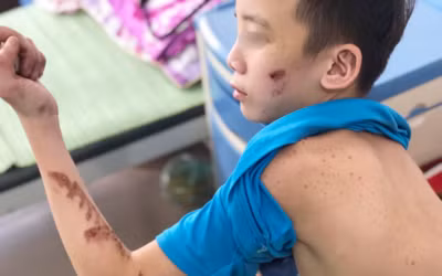 Em Trương Quang D. cho biết trong khoảng 2 tháng làm việc tại quán, em thường bị chủ quán bỏ đói, đánh đập vô cớ