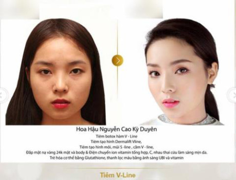 Lộ ảnh Lo anh