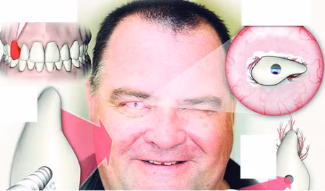 Nhung ca phau thuat ky la va kho tin - Anh 2