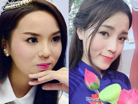 Lộ ảnh Lo anh