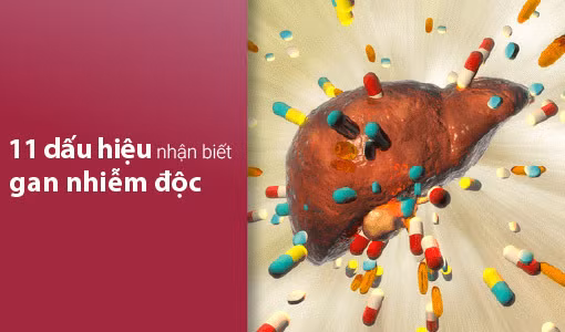 Gan nhiễm độc có thể dẫn đến suy gan