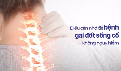 Những lưu ý dành cho người bị gai đốt sống cổ