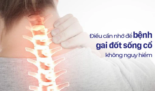 Những lưu ý dành cho người bị gai đốt sống cổ