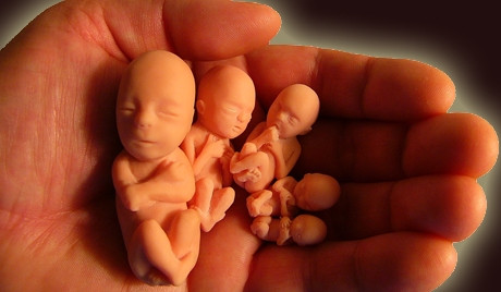 Tỷ lệ nạo phá thai tuổi vị thành niên vẫn còn cao