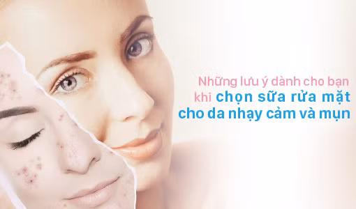Phải rất chú ý khi chọn sữa rửa mặt cho da nhạy cảm và mụn