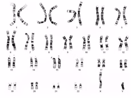 3 nguyen nhan di truyen gay vo sinh o nam gioi, ban co biet? - Anh 2